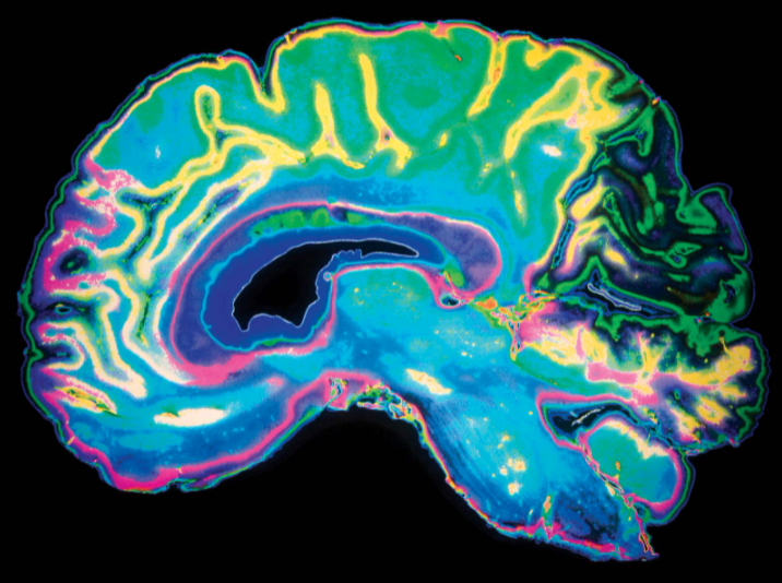Colorful image of a brain